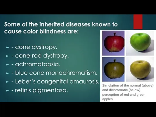 Some of the inherited diseases known to cause color blindness