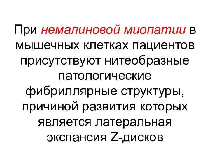 При немалиновой миопатии в мышечных клетках пациентов присутствуют нитеобразные патологические