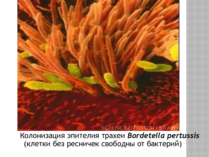 Колонизация эпителия трахеи Bordetella pertussis (клетки без ресничек свободны от бактерий)