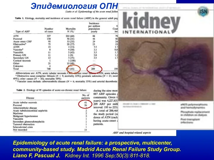 Epidemiology of acute renal failure: a prospective, multicenter, community-based study. Madrid Acute Renal