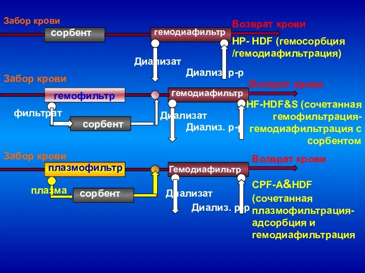 Забор крови Возврат крови Диализ. р-р Диализат сорбент гемодиафильтр гемофильтр гемодиафильтр сорбент Диализат