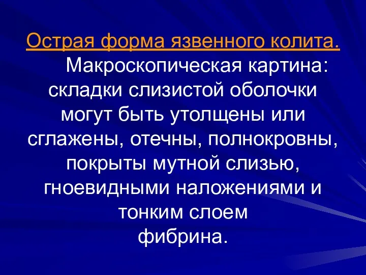 Острая форма язвенного колита. Макроскопическая картина: складки слизистой оболочки могут