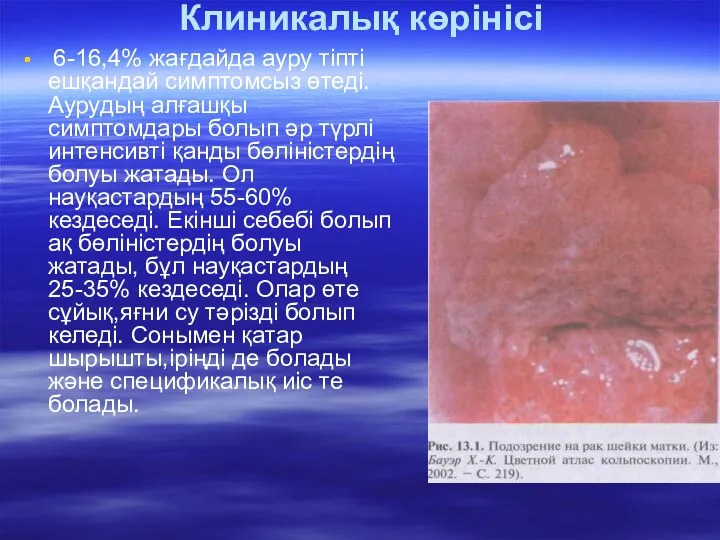 Клиникалық көрінісі 6-16,4% жағдайда ауру тіпті ешқандай симптомсыз өтеді. Аурудың