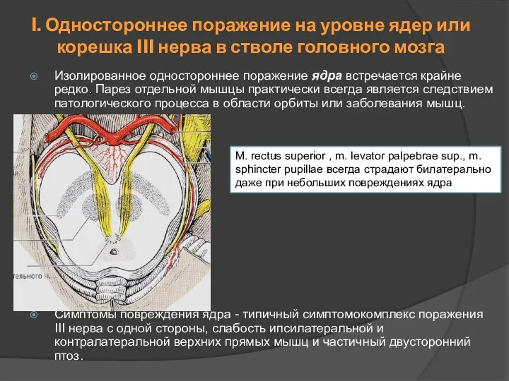 Изолированное одностороннее поражение ядра встречается крайне редко. Парез отдельной мышцы