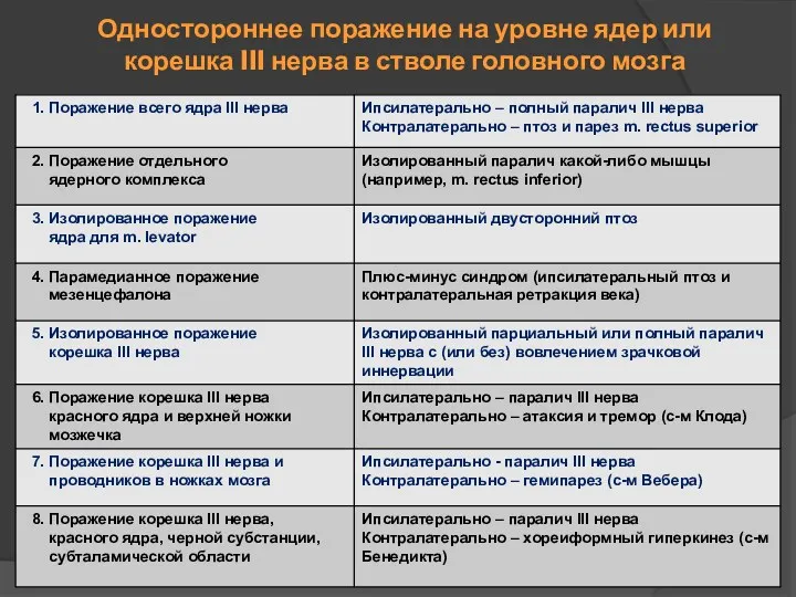 Одностороннее поражение на уровне ядер или корешка III нерва в стволе головного мозга