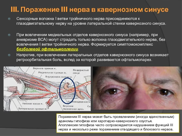 Сенсорные волокна I ветви тройничного нерва присоединяются к глазодвигательному нерву