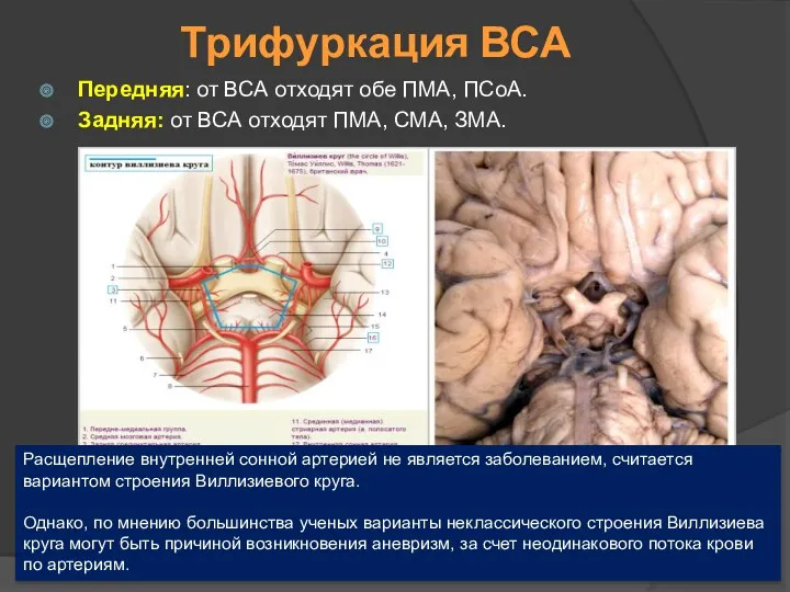 Трифуркация ВСА Передняя: от ВСА отходят обе ПМА, ПСоА. Задняя: от ВСА отходят