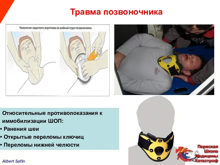 Относительные противопоказания к иммобилизации ШОП: Ранения шеи Открытые переломы ключиц
