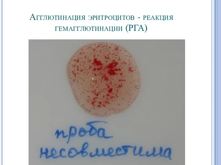 Агглютинация эритроцитов - реакция гемагглютинации (РГА)