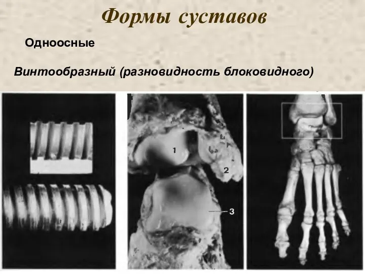 Формы суставов Одноосные Винтообразный (разновидность блоковидного)