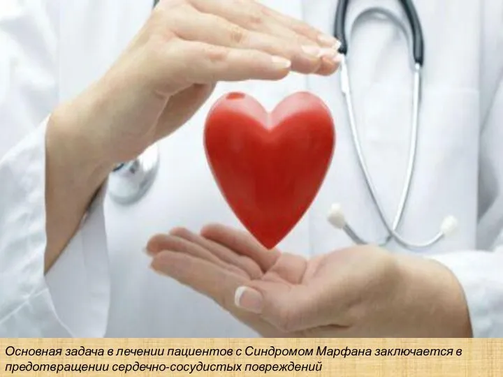 Основная задача в лечении пациентов с Синдромом Марфана заключается в предотвращении сердечно-сосудистых повреждений