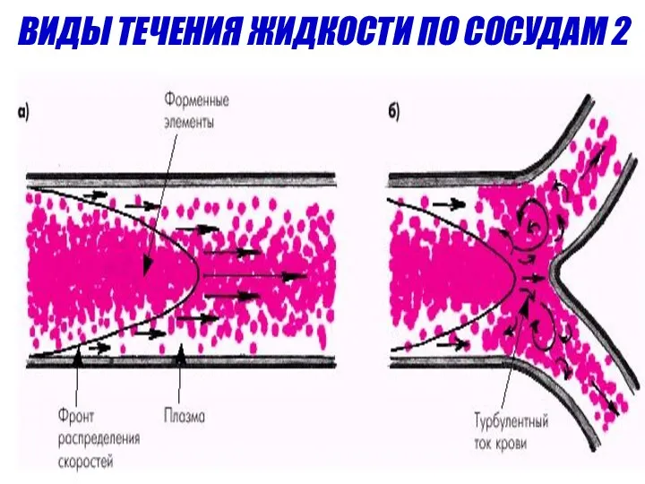 ВИДЫ ТЕЧЕНИЯ ЖИДКОСТИ ПО СОСУДАМ 2