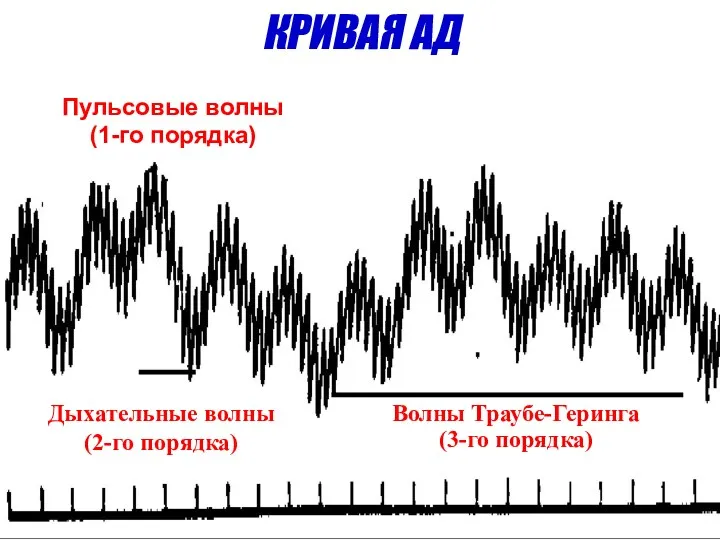 Пульсовые волны (1-го порядка) Дыхательные волны (2-го порядка) Волны Траубе-Геринга (3-го порядка) КРИВАЯ АД