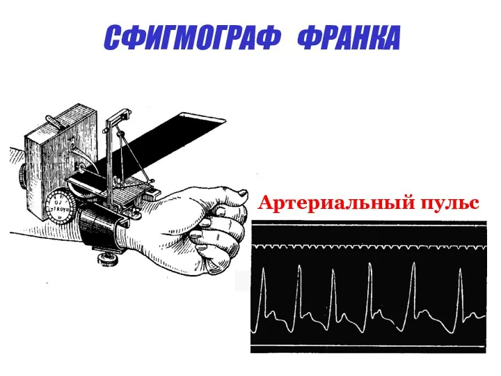 СФИГМОГРАФ ФРАНКА Сфигмограмма артериального пульса Артериальный пульс