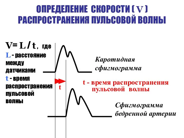 ОПРЕДЕЛЕНИЕ СКОРОСТИ ( V ) РАСПРОСТРАНЕНИЯ ПУЛЬСОВОЙ ВОЛНЫ t Каротидная