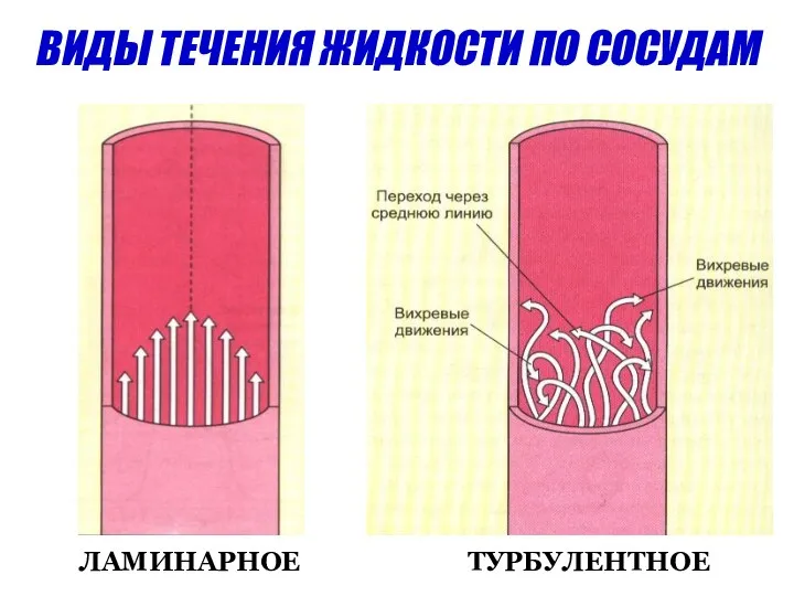 ВИДЫ ТЕЧЕНИЯ ЖИДКОСТИ ПО СОСУДАМ ЛАМИНАРНОЕ ТУРБУЛЕНТНОЕ