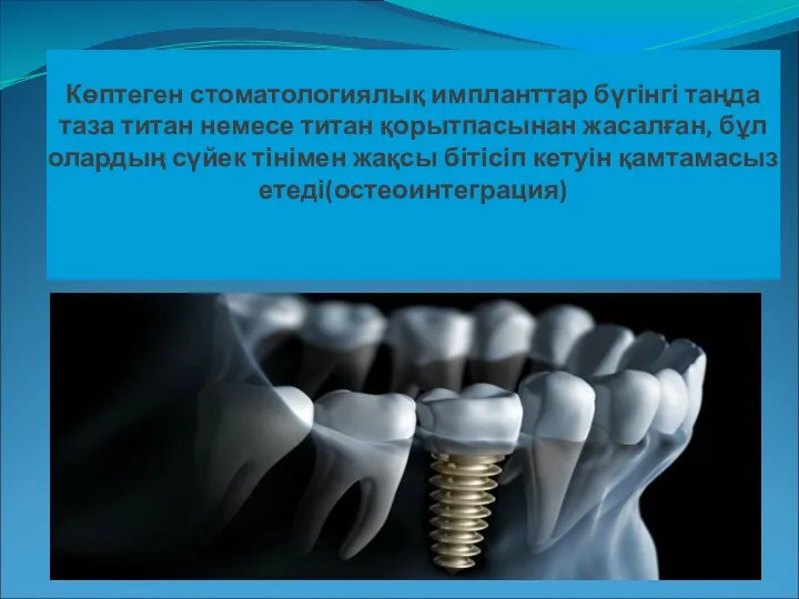 Көптеген стоматологиялық импланттар бүгінгі таңда таза титан немесе титан қорытпасынан