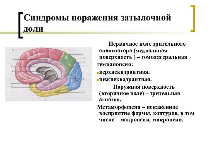 Синдромы поражения затылочной доли Первичное поле зрительного анализатора (медиальная поверхность