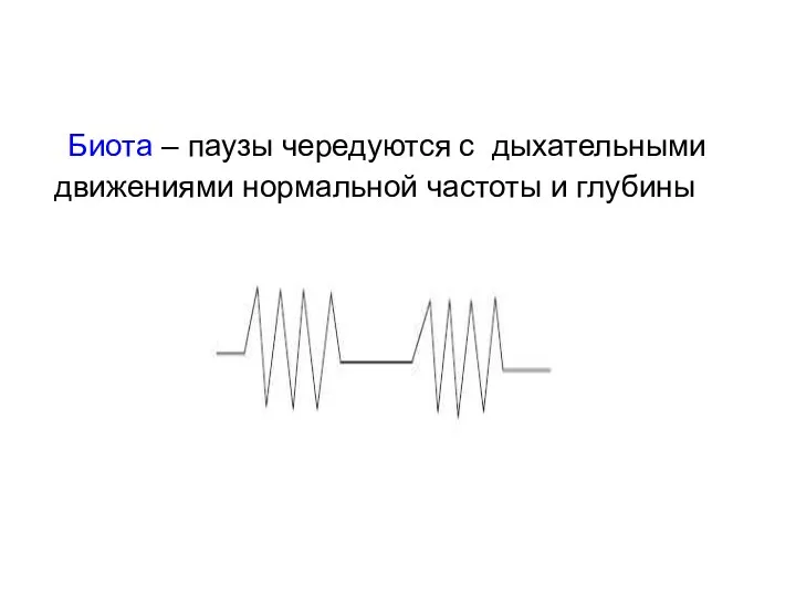 Биота – паузы чередуются с дыхательными движениями нормальной частоты и глубины