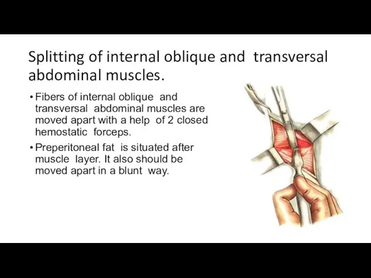 Splitting of internal oblique and transversal abdominal muscles. Fibers of