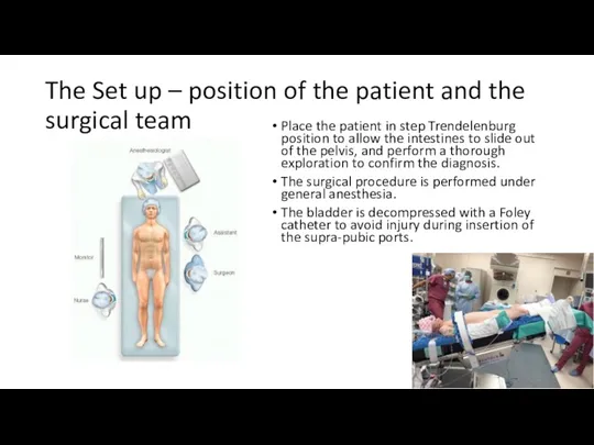 The Set up – position of the patient and the