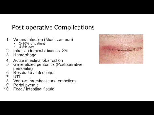 Post operative Complications Wound infection (Most common) 5-10% of patient