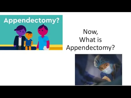 Now, What is Appendectomy?