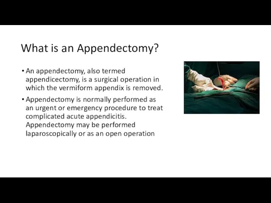 What is an Appendectomy? An appendectomy, also termed appendicectomy, is