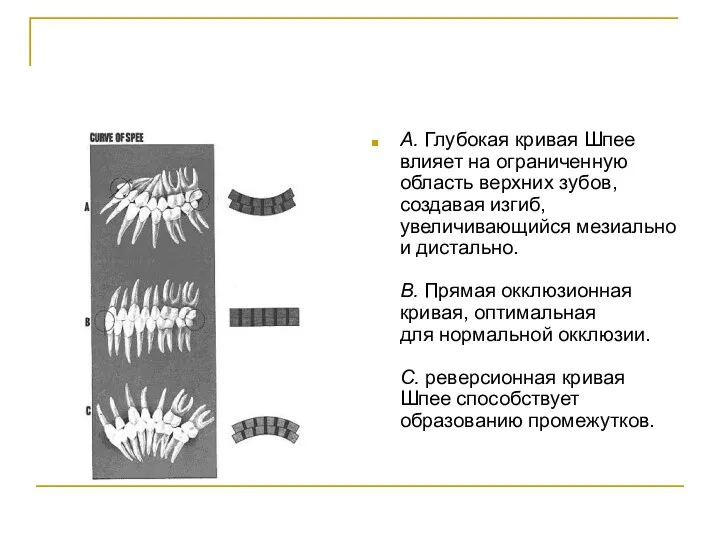 А. Глубокая кривая Шпее влияет на ограниченную область верхних зубов,