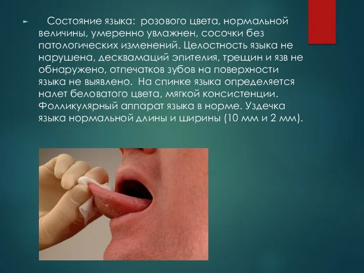 Состояние языка: розового цвета, нормальной величины, умеренно увлажнен, сосочки без