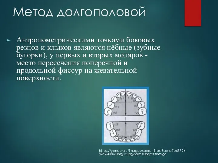 Метод долгополовой Антропометрическими точками боковых резцов и клыков являются нёбные