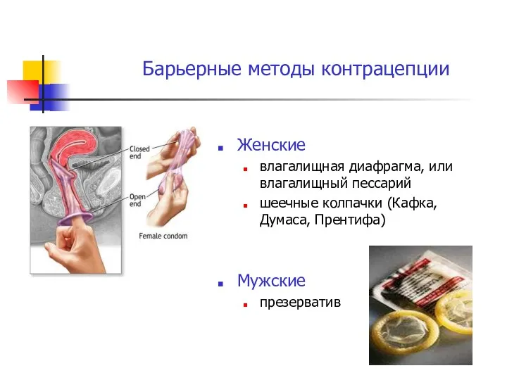 Женские влагалищная диафрагма, или влагалищный пессарий шеечные колпачки (Кафка, Думаса, Прентифа) Мужские презерватив Барьерные методы контрацепции