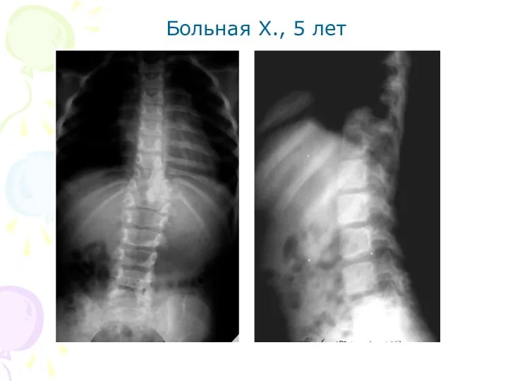 Больная Х., 5 лет