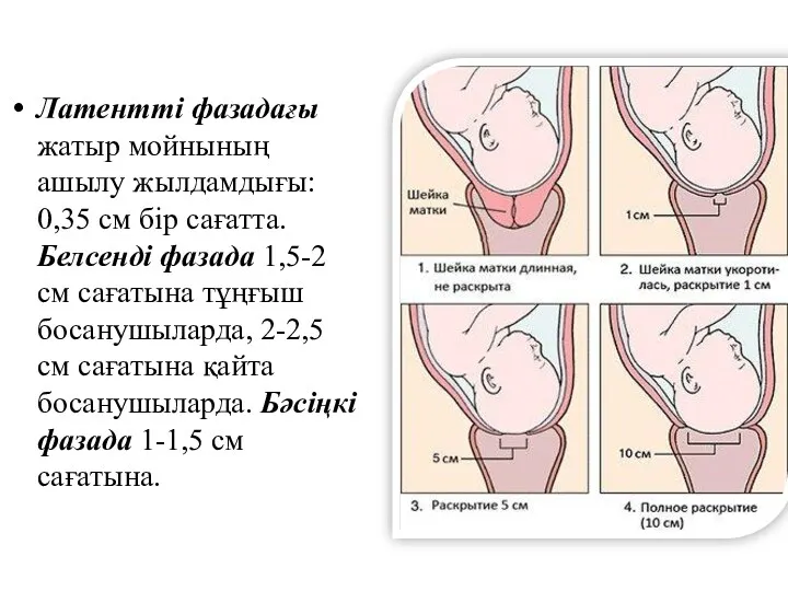 Латентті фазадағы жатыр мойнының ашылу жылдамдығы: 0,35 см бір сағатта. Белсенді фазада 1,5-2