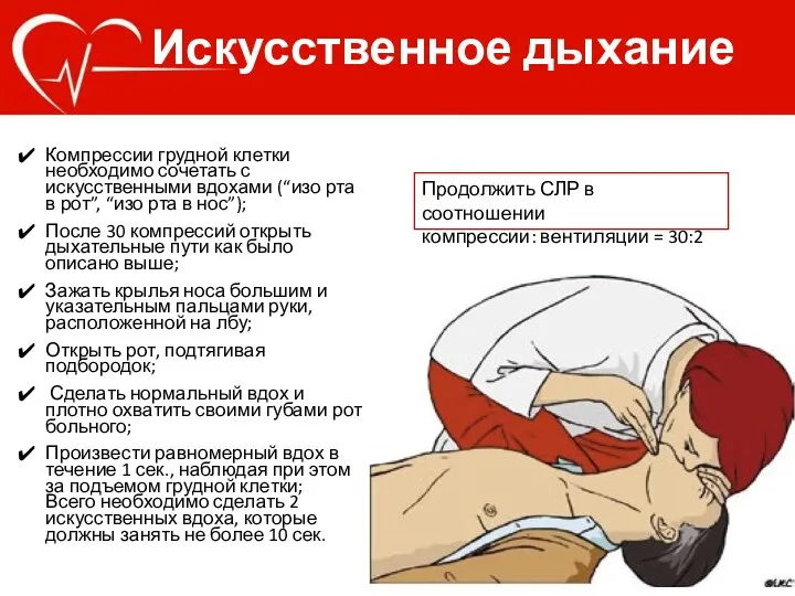 Искусственное дыхание Компрессии грудной клетки необходимо сочетать с искусственными вдохами