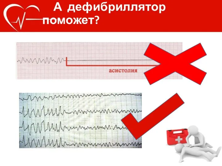 А дефибриллятор поможет?