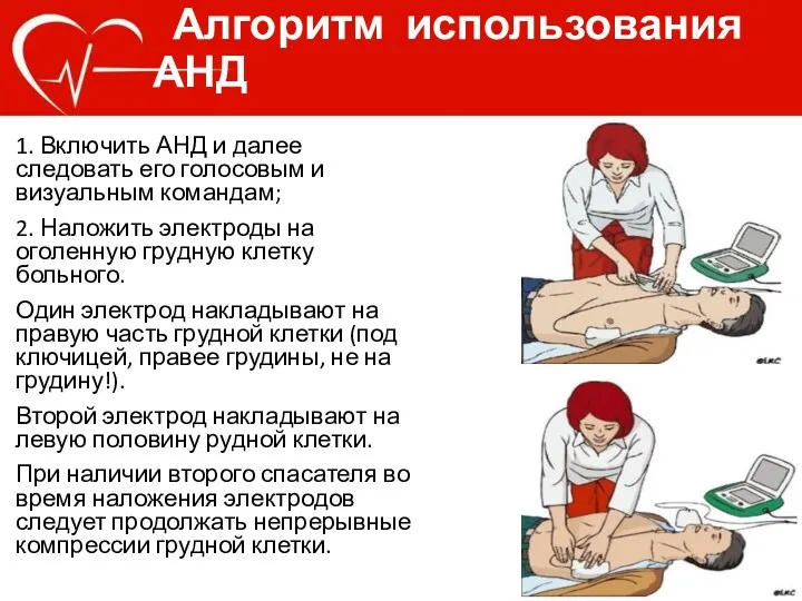 Алгоритм использования АНД 1. Включить АНД и далее следовать его