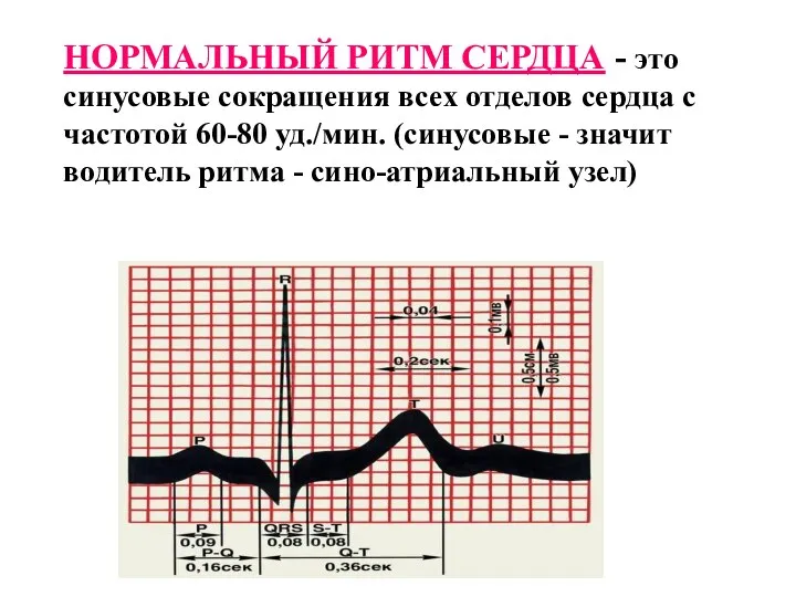 НОРМАЛЬНЫЙ РИТМ СЕРДЦА - это синусовые сокращения всех отделов сердца