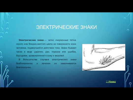 ЭЛЕКТРИЧЕСКИЕ ЗНАКИ Электрические знаки — четко очерченные пятна серого или