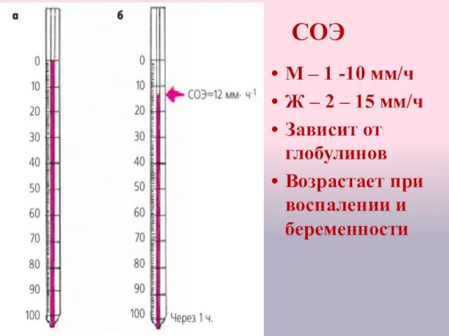 СОЭ М – 1 -10 мм/ч Ж – 2 –