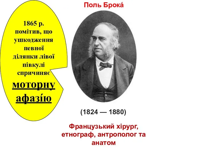 Поль Брокá (1824 — 1880) Французький хі­рург, етнограф, антрополог та