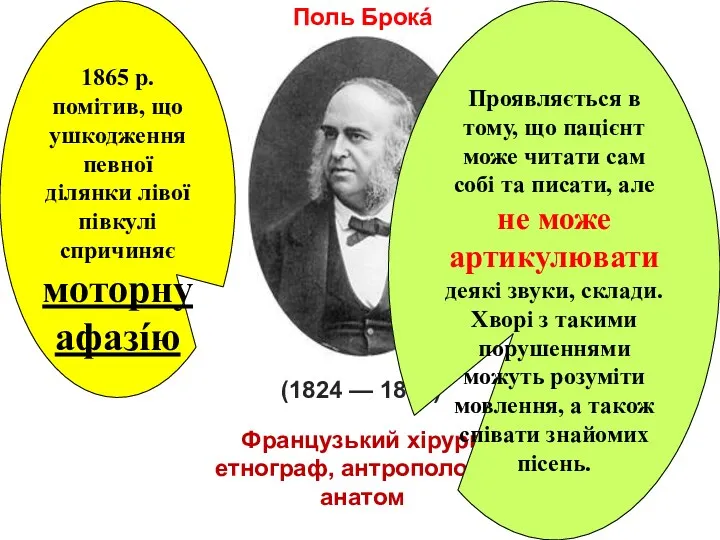 Поль Брокá (1824 — 1880) Французький хі­рург, етнограф, антрополог та