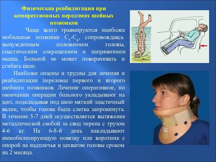 Физическая реабилитация при компрессионных переломах шейных позвонков Чаще всего травмируются