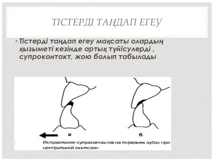 ТІСТЕРДІ ТАҢДАП ЕГЕУ Тістерді таңдап егеу мақсаты олардың қызыметі кезінде