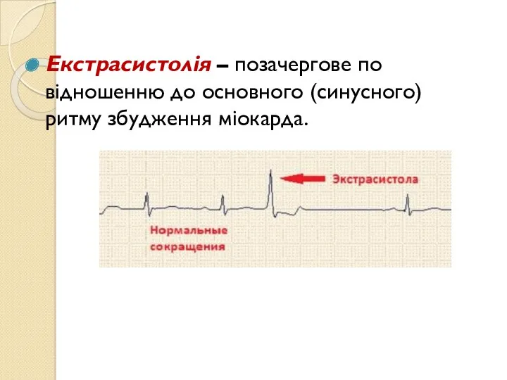 Екстрасистолія – позачергове по відношенню до основного (синусного) ритму збудження міокарда.