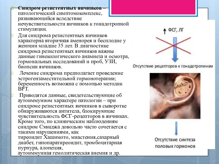 Синдром резистентных яичников – патологический симптомокомплекс, развивающийся вследствие нечувствительности яичников