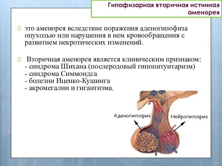 Гипофизарная вторичная истинная аменорея это аменорея вследствие поражения аденогипофиза опухолью