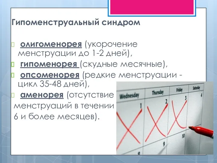 Гипоменструальный синдром олигоменорея (укорочение менструации до 1-2 дней), гипоменорея (скудные