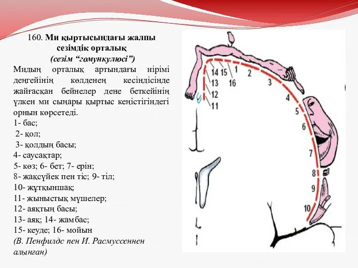 160. Ми қыртысындағы жалпы сезімдік орталық (сезім “гомункулюсі”) Мидың орталық