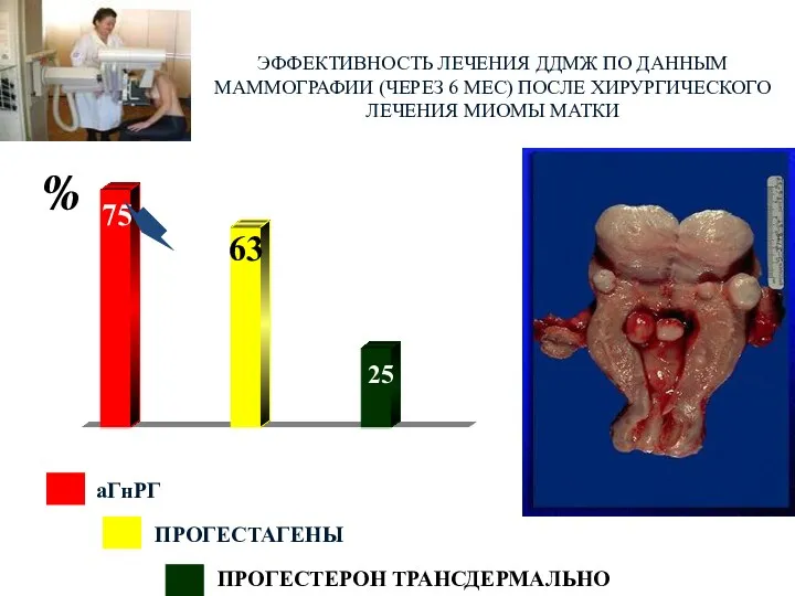 ЭФФЕКТИВНОСТЬ ЛЕЧЕНИЯ ДДМЖ ПО ДАННЫМ МАММОГРАФИИ (ЧЕРЕЗ 6 МЕС) ПОСЛЕ